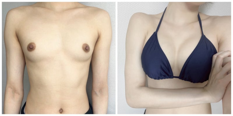 모티바 325,330cc 5개월 경과후기 사진 3