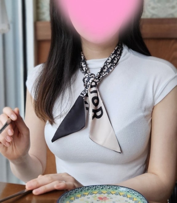 모티바 1년 4개월 차 후기_넥스트성형외과 사진 2