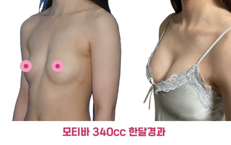 모티바 340cc 한 달 후기