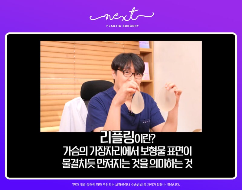 마른체형? 통통한 체형? 체형별 추천되는 보형물 가슴성형수술 사진 5