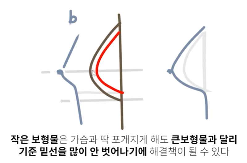 보형물 가슴확대수술 결정 시 중요한 두가지?? 사진 7