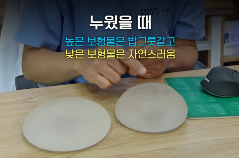 보형물 가슴확대수술 결정 시 중요한 두가지?? 사진 8