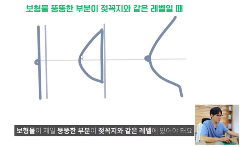 보형물 가슴확대수술 결정 시 중요한 두가지?? 사진 3