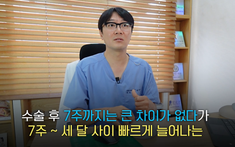 가슴확대 성형수술 - 보형물 크기 결정하기 전 고려해야 할 것 ?? 사진 15